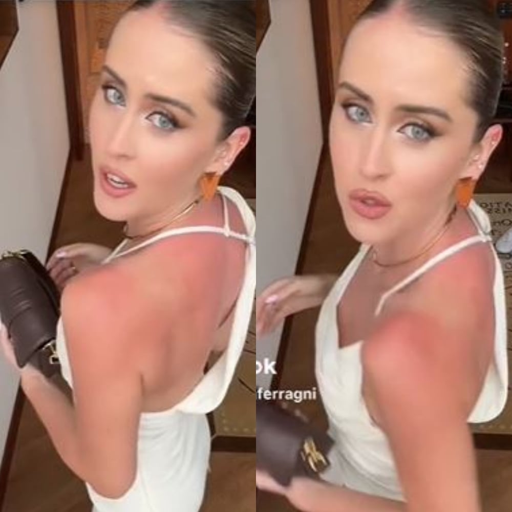 Galleria foto 'Valentina Ferragni, incidente alla sfilata di Jacquemus: “Mi fa un male cane!”' - foto 1