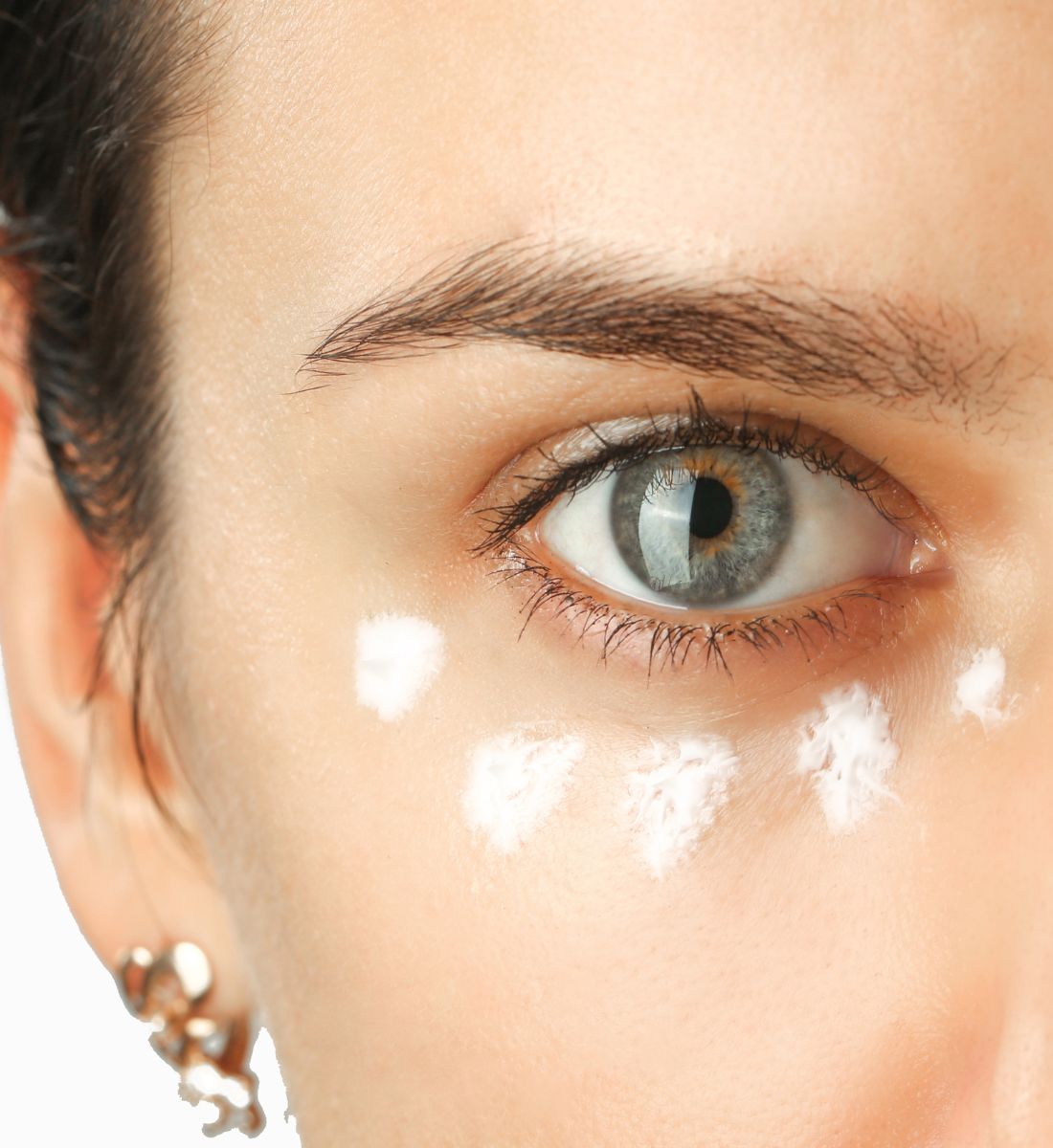 Galleria foto 'Borse e Occhiaie: 8 rimedi e prodotti davvero miracolosi' - foto 3