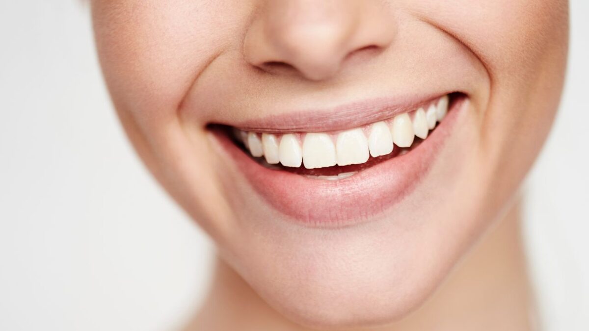 Un Sorriso Top: 5 rimedi naturali per sbiancare i denti!
