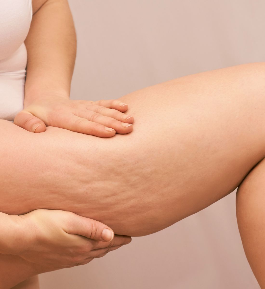 Galleria foto 'Massaggio anticellulite fai da te: scopri come farlo a casa e risparmia!' - foto 5