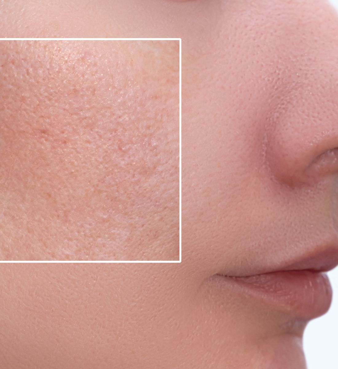 Galleria foto 'Brividi di bellezza: 7 suggerimenti per usare il ghiaccio nella tua routine beauty' - foto 3