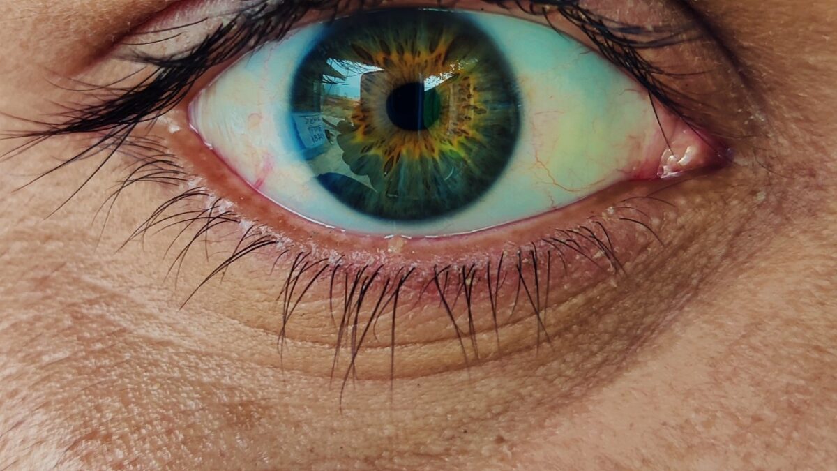 Galleria foto 'Occhiaie nere, quali sono le cause e come eliminarle…' - foto 4