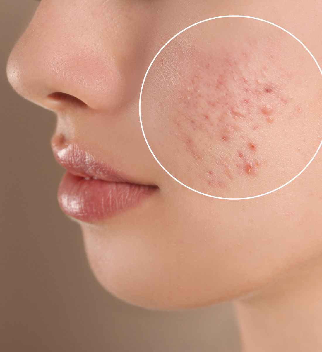 Galleria foto 'Viene dall’Irlanda l’alga “miracolosa” che fa Belle le Celeb!' - foto 3