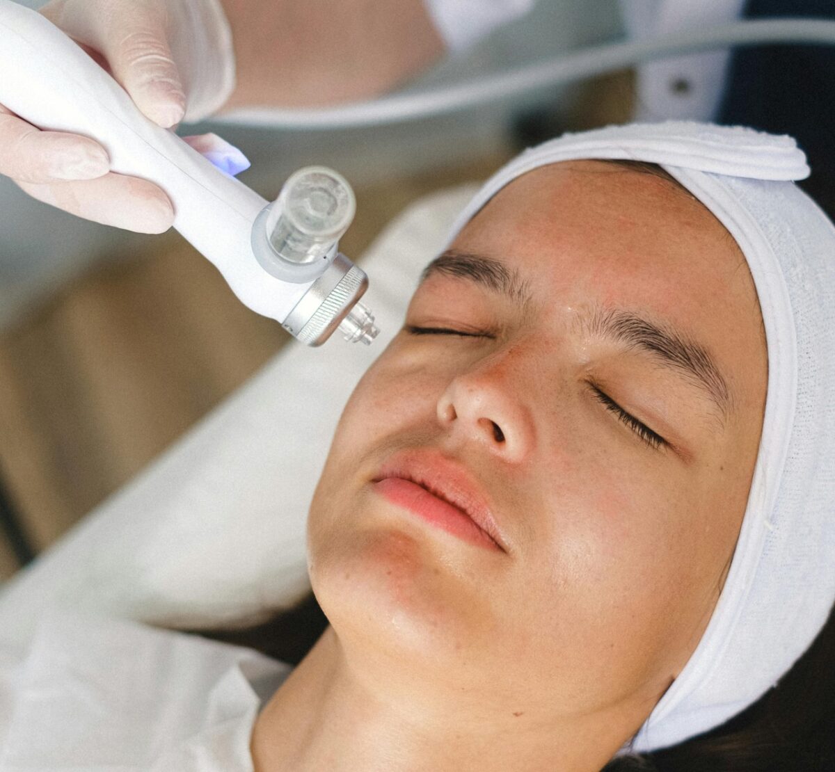 Galleria foto 'Laser Estetico, i trattamenti da mettere in Calendario questo inverno' - foto 3