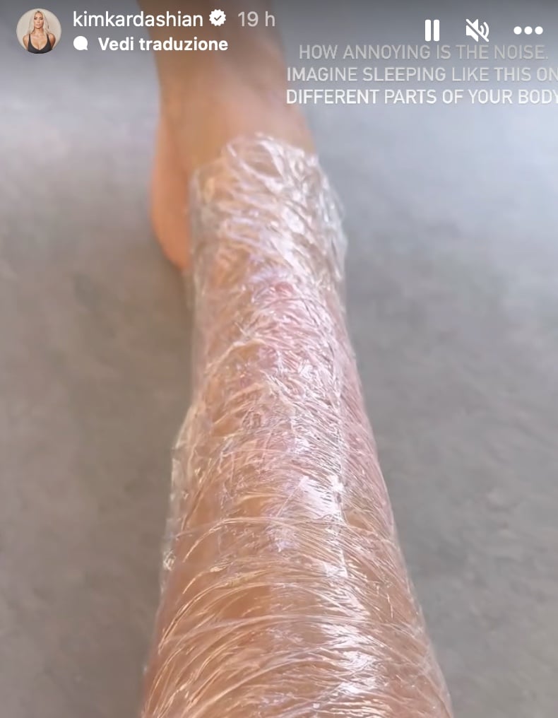 Galleria foto 'Kim Kardashian, la battaglia contro la Psoriasi diventa difficile: cosa ha mostrato su Instagram' - foto 1