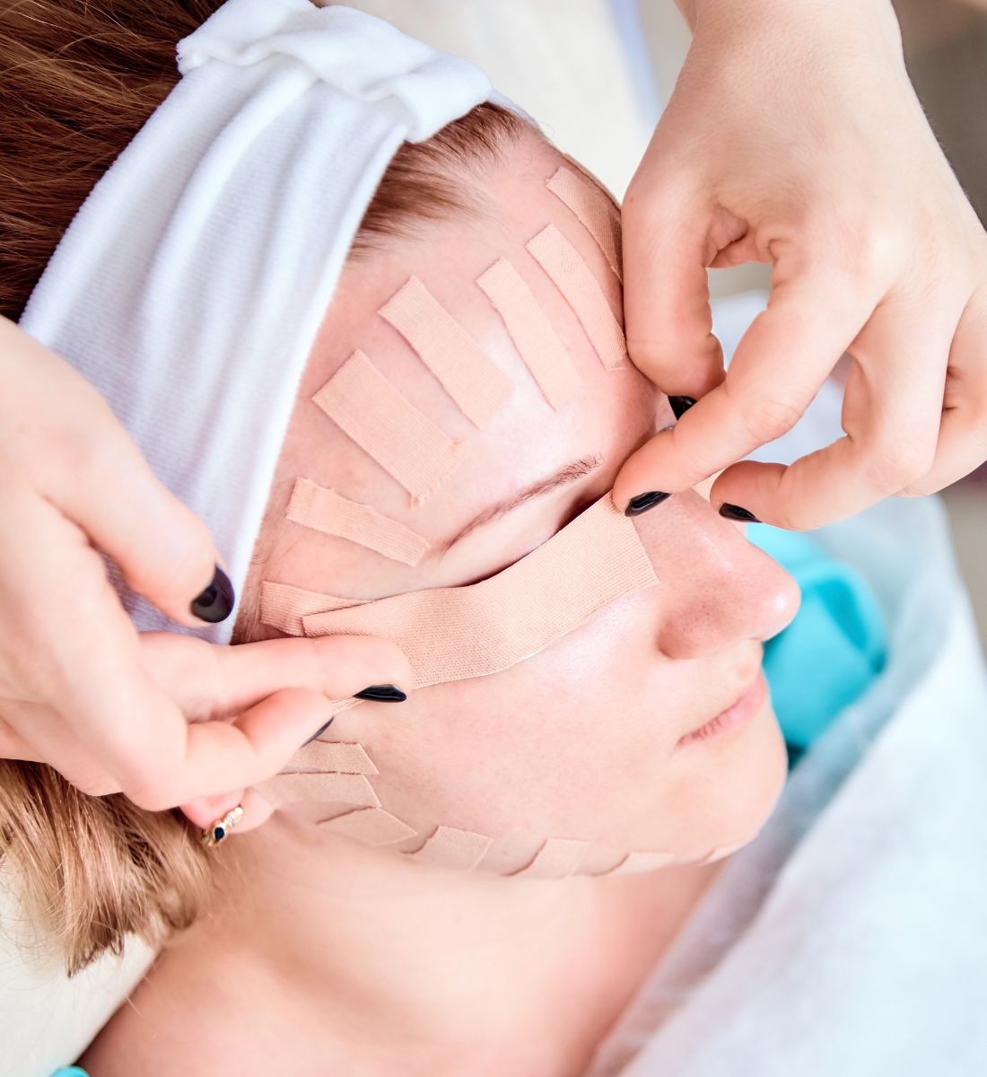 Galleria foto 'Face taping: lifta il viso in modo naturale!' - foto 2