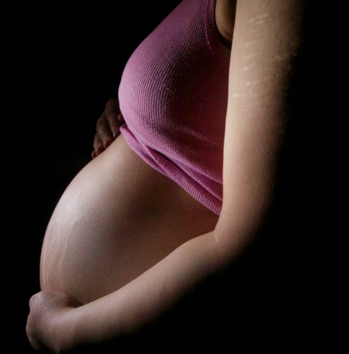 Galleria foto 'Un rimedio naturale contro le Smagliature, perfetto anche in gravidanza…' - foto 4