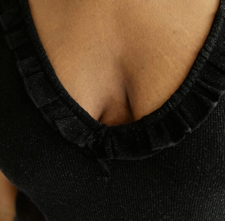 Un rimedio naturale contro le Smagliature, perfetto anche in gravidanza… Un rimedio naturale contro le Smagliature, perfetto anche in gravidanza…