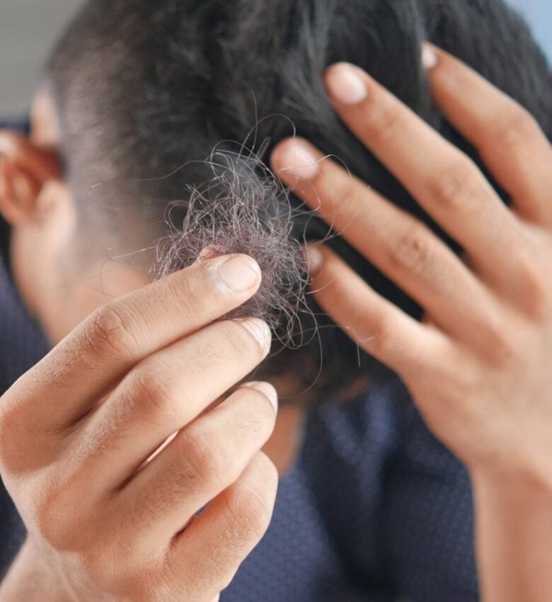 perche cadono i capelli
