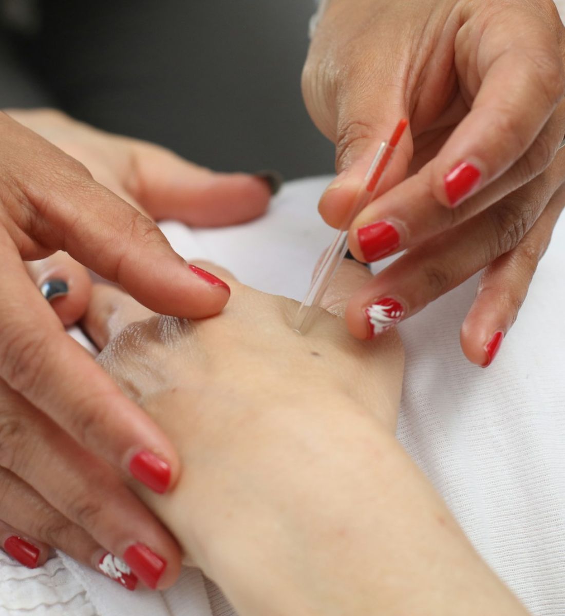 Galleria foto 'Questo è il trattamento viso del futuro, da poco sbarcato anche in Italia' - foto 3