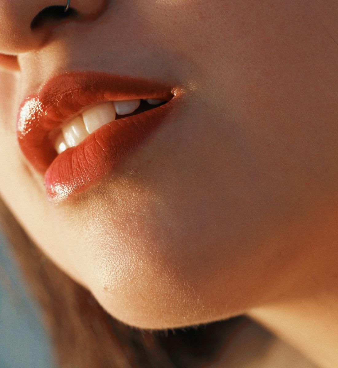 Galleria foto 'Botox o filler? Ecco le differenze per scegliere tra l’uno e l’altro' - foto 3