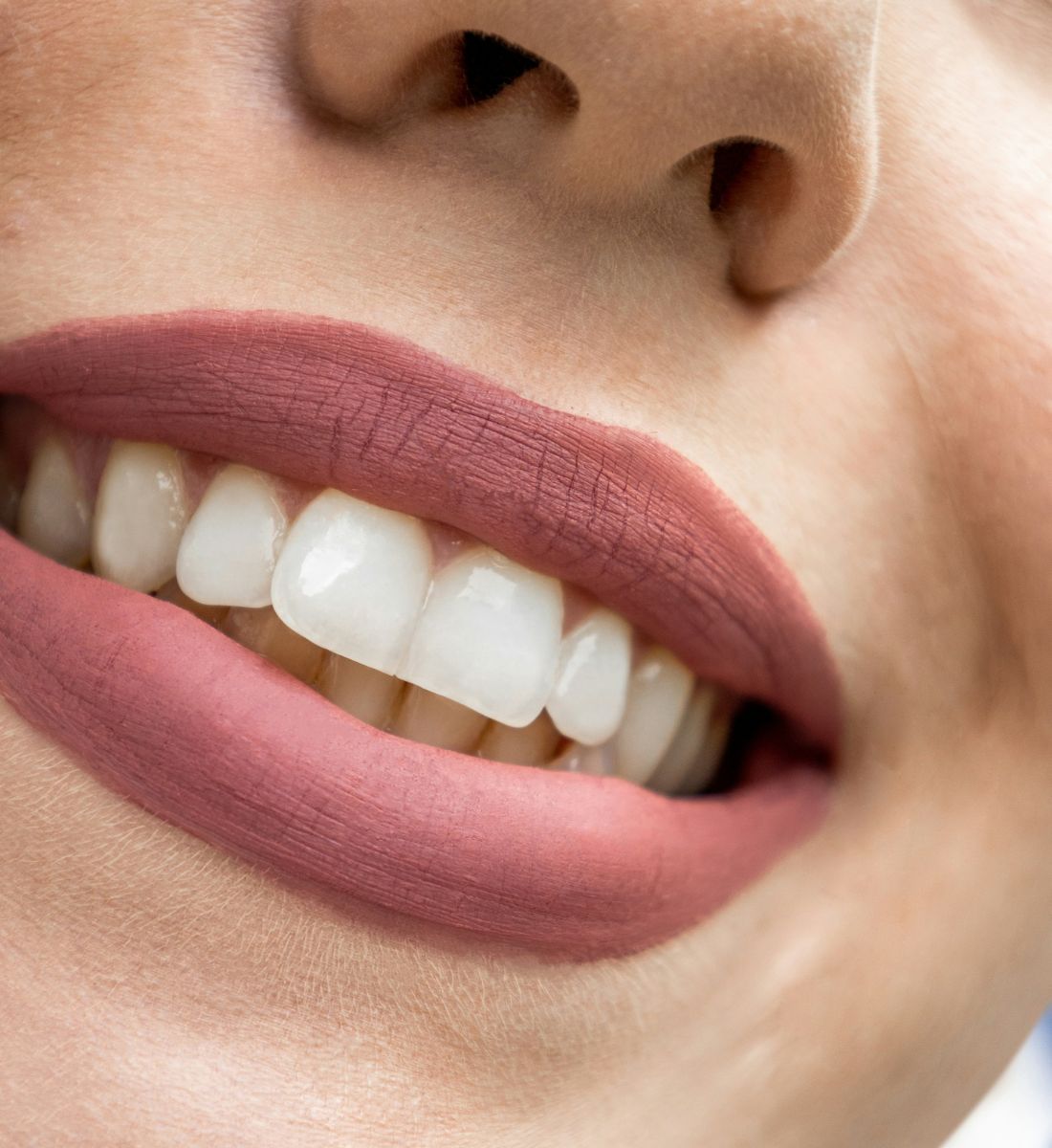 Galleria foto 'Sorriso senza rughe: gli esercizi per togliere i segni attorno alle labbra' - foto 2