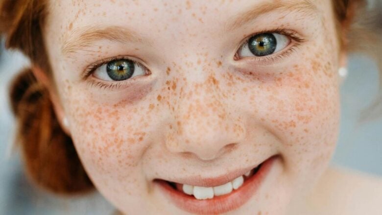 Gen Alpha e skincare, i prodotti giusti per trattare la pelle in adolescenza (senza esagerare)